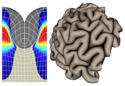 Links mit einem Raster verdeutlichter Querschnitt einer Furche eines Gehirns in unterschiedlichen Schattierungen, rechts ein simuliertes Gehirn in verschiedenen Schattierungen.