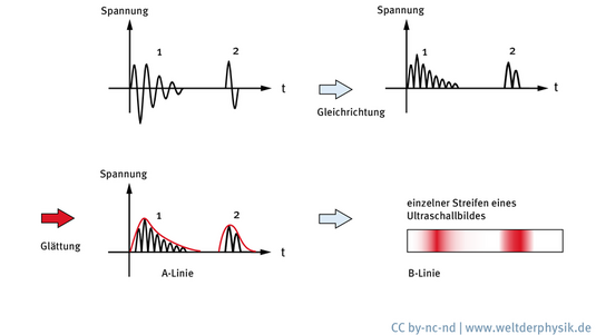 Diagramm mit Spannungswellen und entsprechenden Streifen auf dem Ultraschallbild