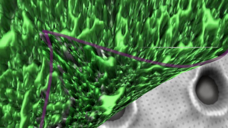Biofilm schält sich von Oberfläche mit mikroskopischen Kratern ab
