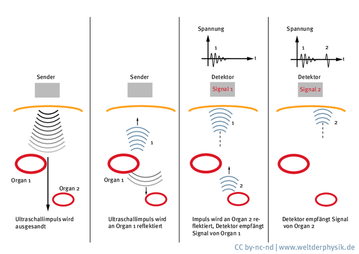 Ultraschallimpulse im Körper und ihre Messung Eine einfache Ultraschallmessung läuft in mehreren Schritten ab. Zunächst wird der Ultraschallimpuls in den Körper eingestrahlt. Dort wird er von verschieden tief liegenden Organen zu unterschiedlichen Zeiten und unterschiedlich stark reflektiert. Diese Reflexion wird wiederum gemessen und in ein elektrisches Signal verwandelt. Dadurch erhält man ein Spannungs-Zeit-Diagramm.