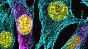 Auf der Mikroskopaufnahme sind mehrere gelbe Punkte vor dunklem Hintergrund zu sehen, die von netzartigen Strukturen umhüllt werden.
