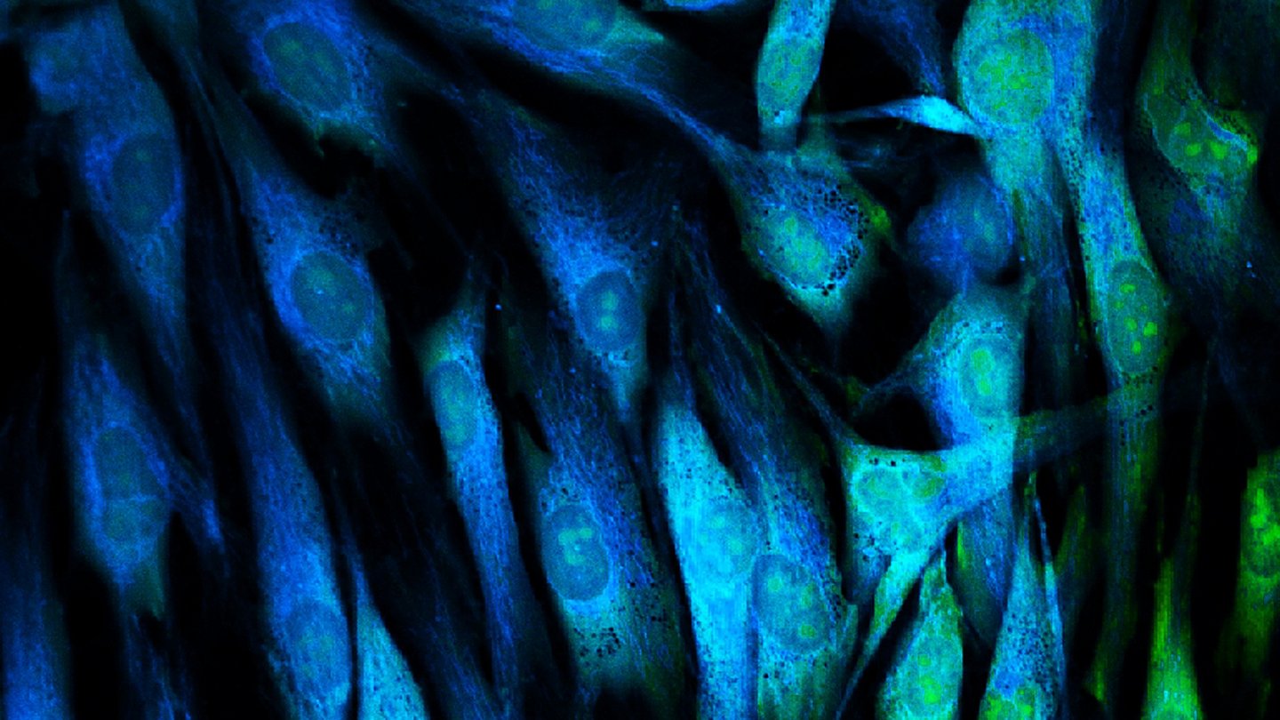 Fisikawan: mikroskop fluoresensi DIY