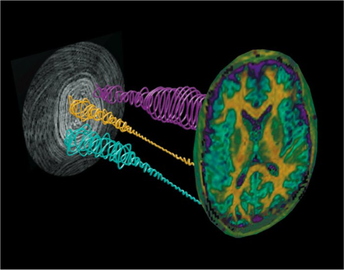 Prinzip des Magnetresonanz-Fingerabdrucks Grafik: Zwischen zwei nahezu kreisrunden Flächen verlaufen ungeordnete Spiralen, die die Kernspin-Signale veranschaulichen sollen