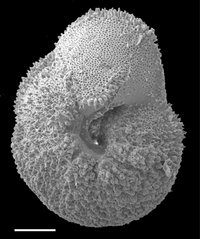 Das Bild zeigt eine Aufnahme des mikroskopisch kleinen Meeresfossils, das rundlich ist und eine spitze Struktur auf der Oberfläche hat.