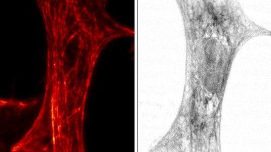 Das Bild zeigt zwei unterschiedliche Aufnahmen derselben Herzmuskelzelle.