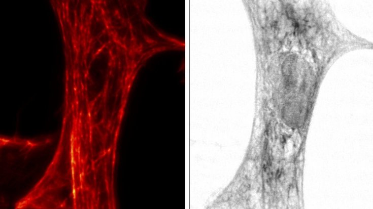 Das Bild zeigt zwei unterschiedliche Aufnahmen derselben Herzmuskelzelle.