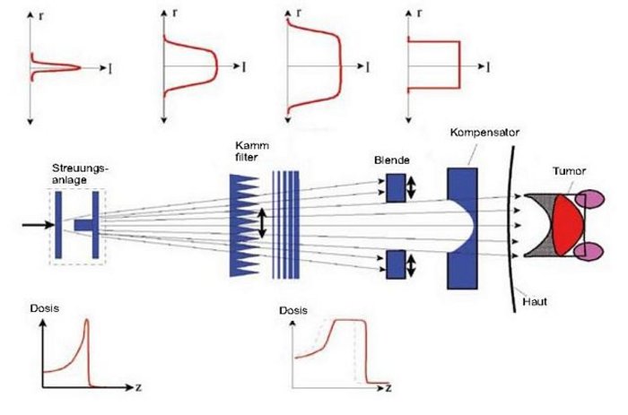 Schemazeichnung mit Strahlengang von links nach rechts, aufweitend: durch Streuungsanlage, Kammfilter, Blenden, Kompensator, Haut und Tumor. Parallel darüber vier Grafen der Strahlenbreite und -form, von schmalem Radius jeweils breiter werdend bis zu eckiger Form nach Blendendurchgang. Unter der Schemazeichnung: Dosisgraf verändert Form von relativ steil aufsteigendem Peak zu flacher aufsteigend und Hochplateau bildet, jeweils vor steilem Abfall.