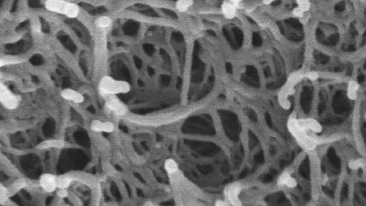 Struktur des Aerogels unter dem Mikroskop