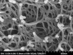 Mikroskopbild in schwarz-weiß, es sind zahlreiche Verästelungen und Hohlräume in der Struktur zu erkennen.