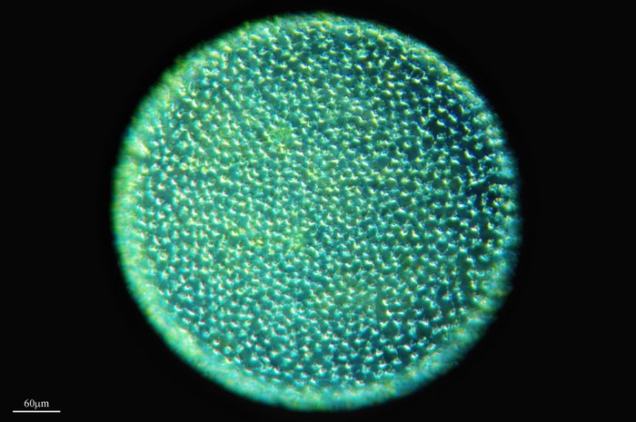 Mikroskopbild einer grünlichen Kugel aus Zellen mit körniger Oberfläche.