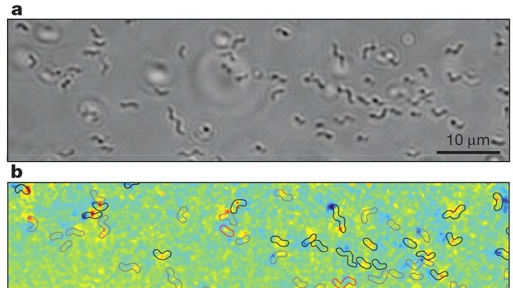 Verschiedene Aufnahmen von Bakterien unter dem Mikroskop