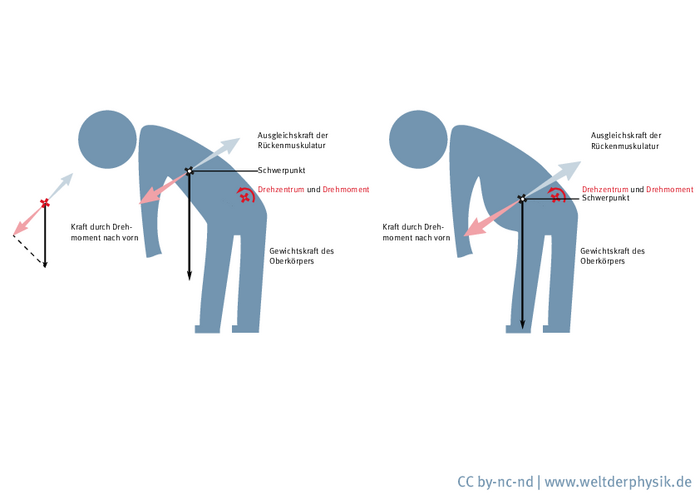 Illustration zweier Männer, die sich nach vorn beugen, einer ist dicker als der andere. Drehzentrum und Schwerpunkt sind im unteren Bereich des Rückens eingezeichnet, der Schwerpunkt bei der schwereren Person liegt weiter vorn und damit weiter vom Drehzentrum entfernt. Die Pfeile, die die wirkende  die Kraft nach unten und die Kompensationskraft der Muskeln nach oben anzeigen, werden dadurch länger, die Kräfte sind also größer.