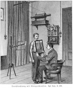 Historische Zeichnung, der Patient steht mit freiem Oberkörper vor einer Röntgenquelle, der Arzt sieht durch ein spezielles Glas die Rippen.