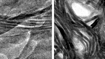 Hochaufgelöste Mikroskopaufnahme von Knochengewebe: Winzige Fasern ordnen sich zu grob parallel ausgerichteten fedrigen Bündeln zusammen.