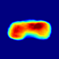 Rekonstruktion eines Cyanobakteriums aus dem Röntgenstreubild abgebildet in rot, gelb, grün und blau Tönen.