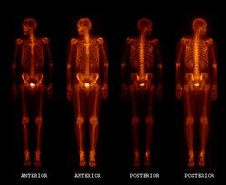 Auf der Aufnahme ist das Skelett eines Menschen zu sehen, das hell durch die Haut und den Körper durchscheint, die schwach rötlich zu erkennen sind.