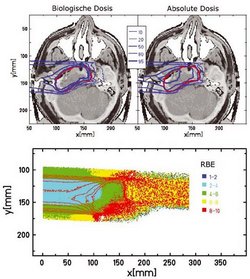 Zwei Schädelbilder von oben, darauf in blau/roten Linien aufgetragen der Flächenverlauf der "Biologischen Dosis" beziehungsweise der "Absoluten Dosis", zentriert etwa in der Schädelmitte. Unten grün-gelb-rotes Intensitätsbild, dabei y(mm) aufgetragen gegen x(mm).