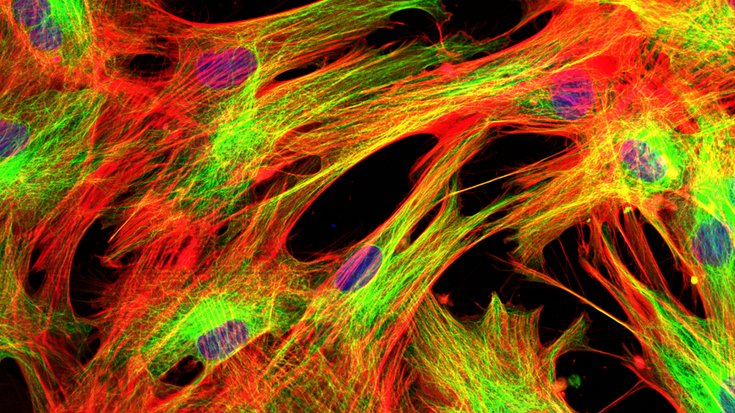 Mikroskopaufnahme von Zellen, die in verschiedenen Farben leuchten. Die Zellen sind über dünne Stränge miteinander verbunden.