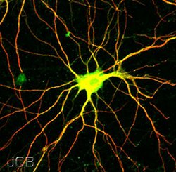 Dargestellt ist eine Nervenzelle mit Axonen.