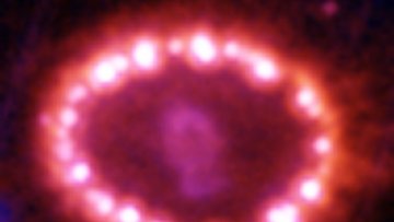 SN1987A