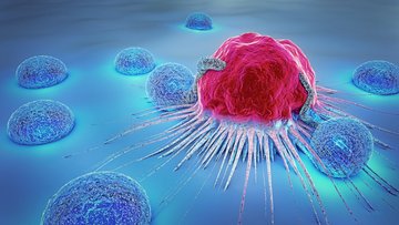 Die Grafik zeigt eine Krebszelle als unförmige Kugel, die von mehreren Lymphozyten umgeben ist.