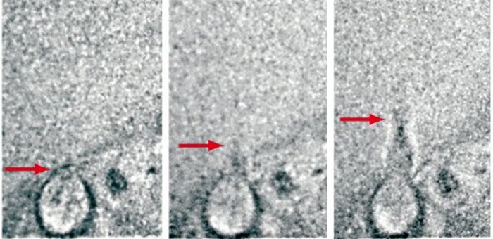 Nesselfäden von Quallen Nesselfäden von Quallen