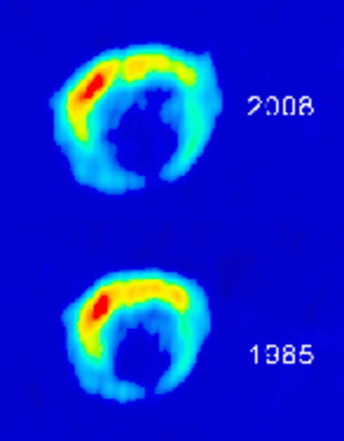 Supernova-Überrest G1.9+0.3