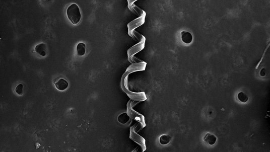 Mikroskopaufnahme, auf der ein spiralförmiger Strang zu sehen ist
