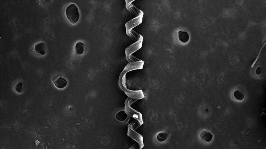 Mikroskopaufnahme, auf der ein spiralförmiger Strang zu sehen ist