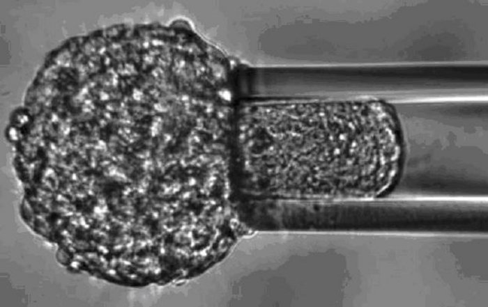 Mikropipette Mikropipette