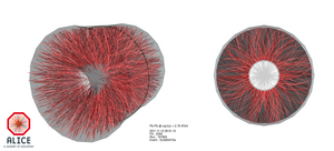 Diagramm: Eine unüberblickbare Vielzahl an Teilchenspuren durchzieht das Modell eines Teilchendetektors. Beschriftung: Blei-Blei-Kollision im ALICE-Detetkor.
