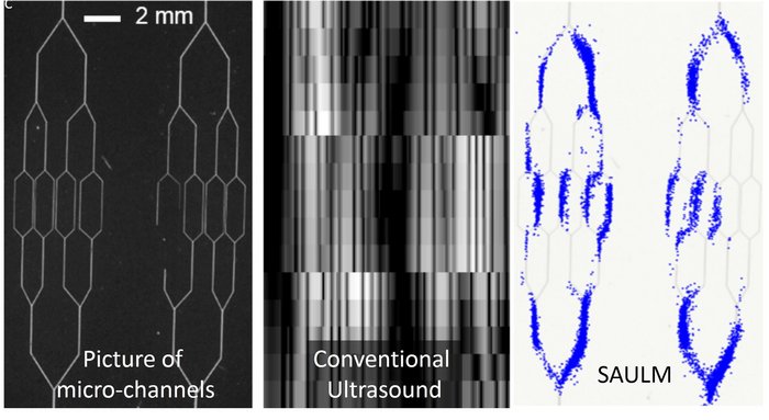 Insgesamt drei Bilder sind dargestellt. Linkes Bild: filigrane, sich verzweigende Linien der Mikrokanäle. Mittleres Bild: grobe Klötzchen in verschiedenen Helligkeiten, hier sind die feinen Linien nicht erkennbar. Rechtes Bild: filigrane, sich verzweigende Linien der Mikrokanäle, an denen sich haufenweise Punkte – die Mikroblasen – angelagert haben.