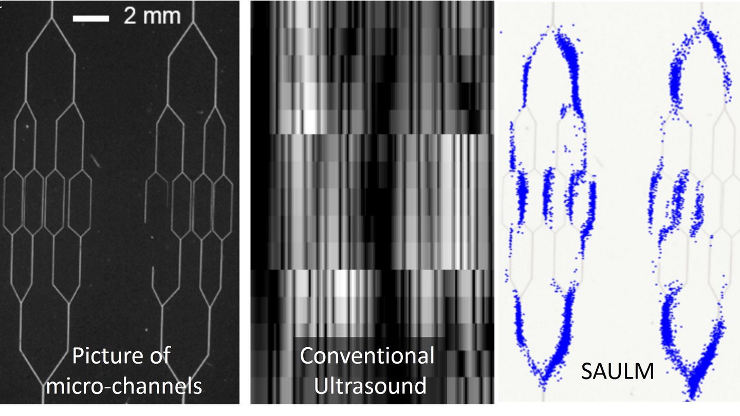 Welt der Physik Schärfere Ultraschallbilder dank Mikroblasen