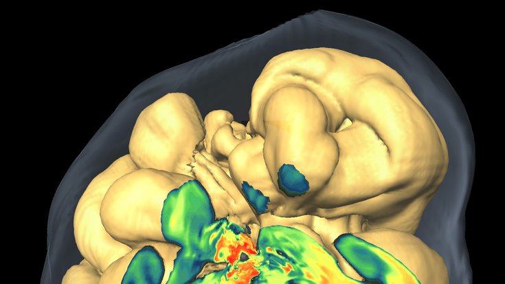 3D-Simulation einer Supernova