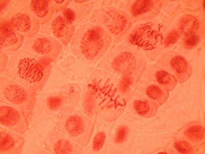 Rötlich eingefärbtes Mikroskopbild von einem Verband von Zellen. Drei davon befinden sich in unterschiedlichen Phasen der Teilung, in ihnen sind die Chromosomen als fadenförmige Strukturen deutlich erkennbar, sie befinden sich in der Mitte der Zelle und werden nach zwei Seiten auseinander gezogen.