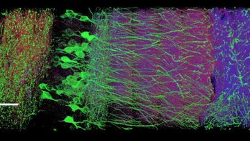 Mikroskopaufnahme einer Gewebeprobe, bunte Strukturen auf schwarzem Hintergrund