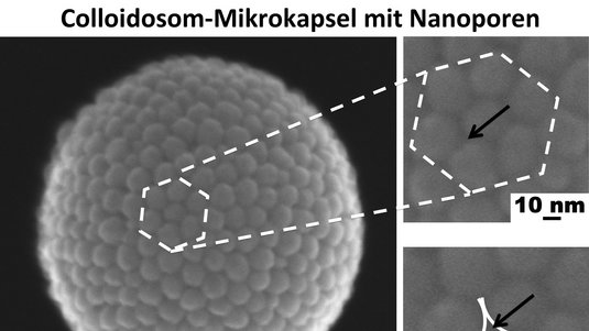 Mikroskopaufnahme einer kugelförmigen Struktur