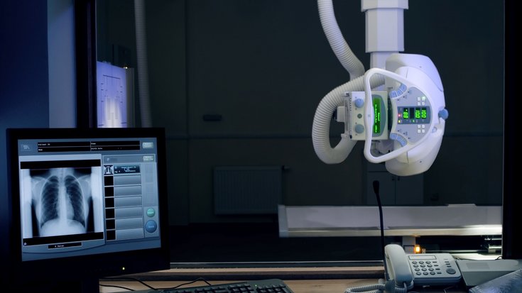 Von der Decke hängt ein Apparat, der mit Schläuchen, einen Bügel und leuchtenden Displays ausgestattet ist. Links im Vordergrund steht ein Monitor auf einem Schreibtisch, auf dem das Röntgenbild eines Brustkorbs zu sehen ist.