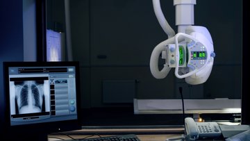 Von der Decke hängt ein Apparat, der mit Schläuchen, einen Bügel und leuchtenden Displays ausgestattet ist. Links im Vordergrund steht ein Monitor auf einem Schreibtisch, auf dem das Röntgenbild eines Brustkorbs zu sehen ist.