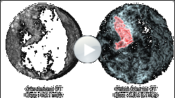 CT-Scan, Quelle: ESRF, LMU/Brun CT-Scan