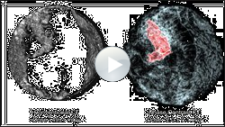 CT-Scan