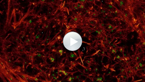 Cytoskelett einer lebenden Zelle unter einem Fluoreszenzmikroskop Cytoskelett einer lebenden Zelle unter einem Fluoreszenzmikroskop