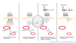 Diagramm mit Ultraschallwellen, Organen und Sensor